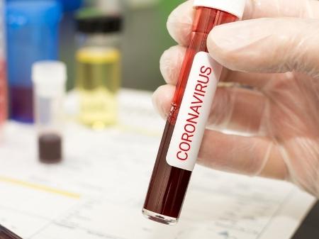 Brasil fará testes em massa neste mês para saber número de infectados por coronavírus